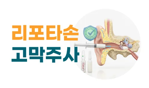 리포타손 고막주사: 귀 단면 그림에 주사기를 대는 모습