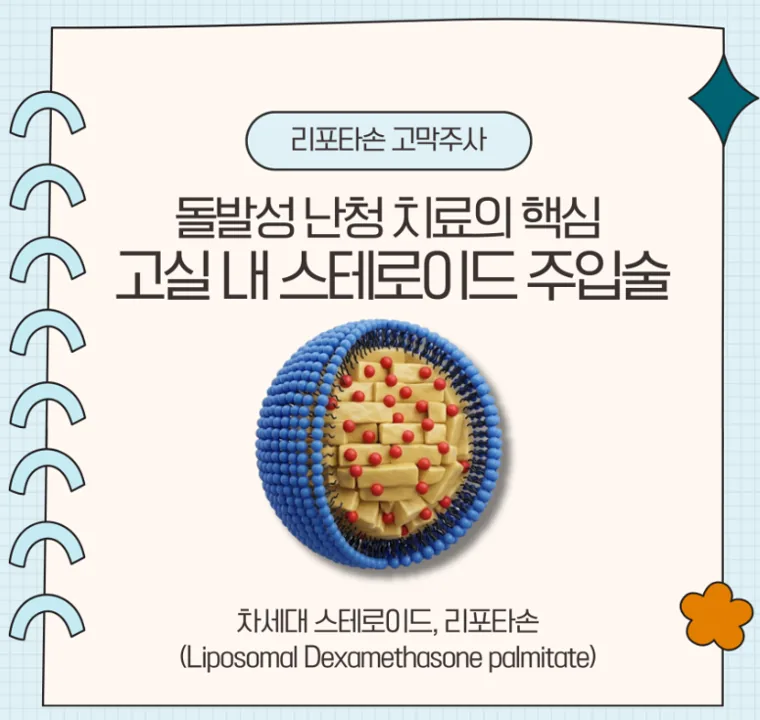 리포타손 고막주사 카드: 돌발성 난청 치료의 핵심, 고실 내 스테로이드 주입술. 차세대 스테로이드 리포타손(Liposomal Dexamethasone palmitate)